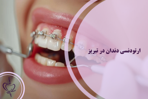 ارتودنسی دندان در تبریز