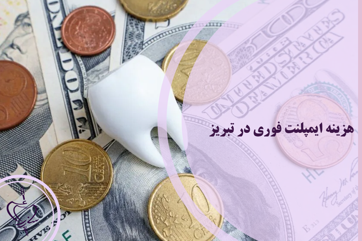 هزینه ایمپلنت فوری در تبریز