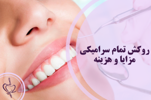 روکش تمام سرامیکی