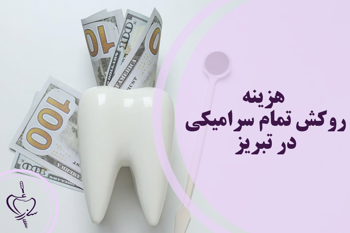 هزینه روکش تمام سرامیکی در تبریز