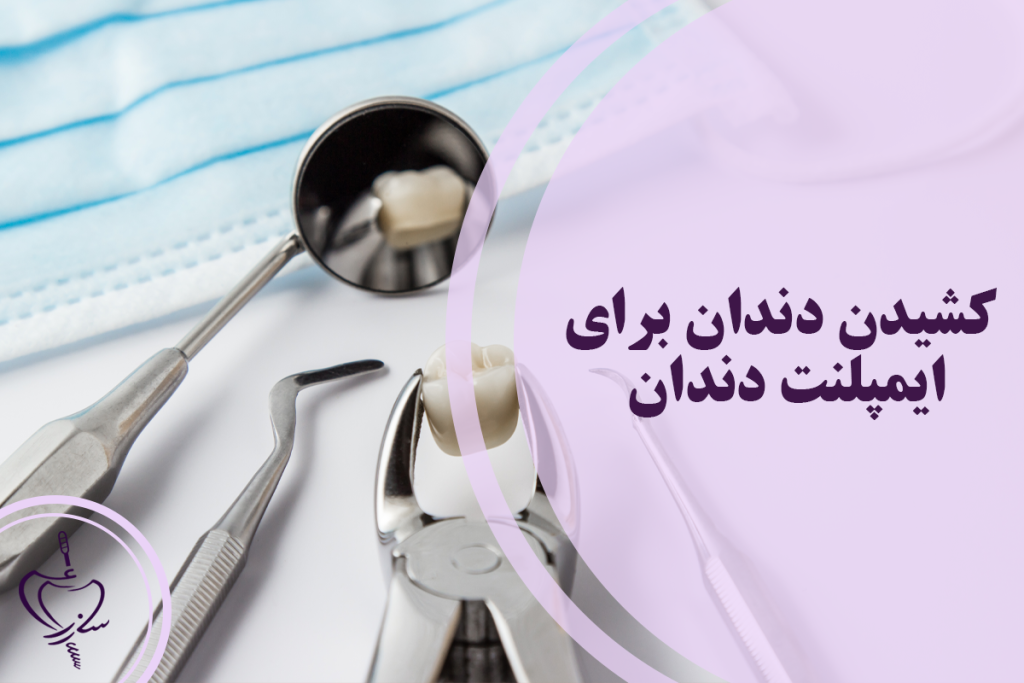 کشیدن دندان برای ایمپلنت