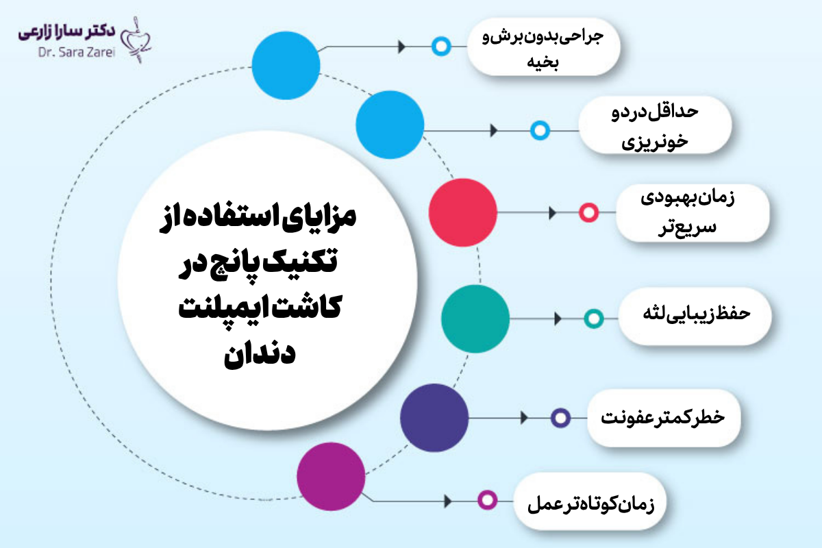 مزایای استفاده از تکنیک پانچ در کاشت ایمپلنت دندان