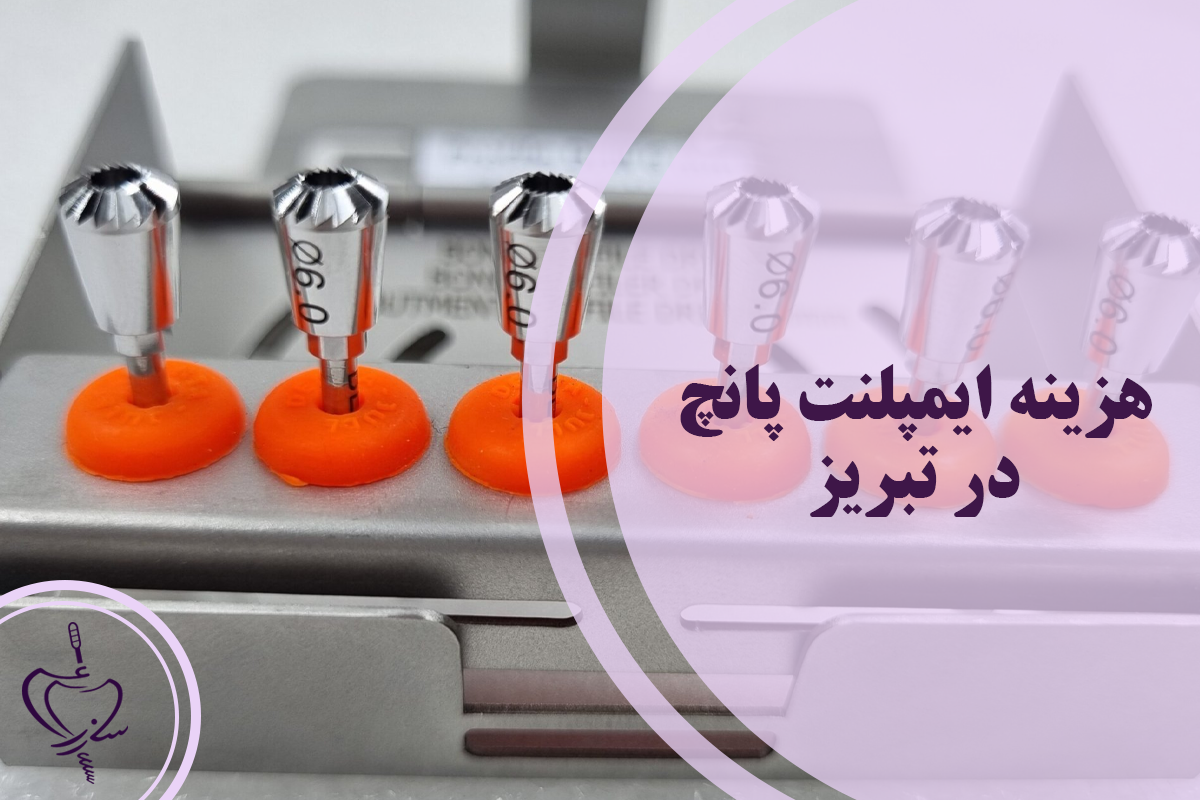 هزینه ایمپلنت پانچ در تبریز