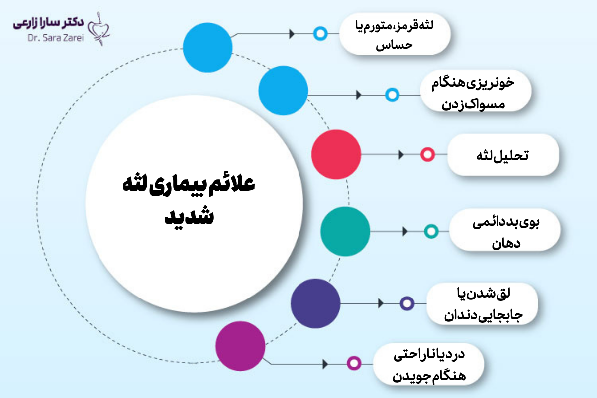علائم بیماری لثه شدید