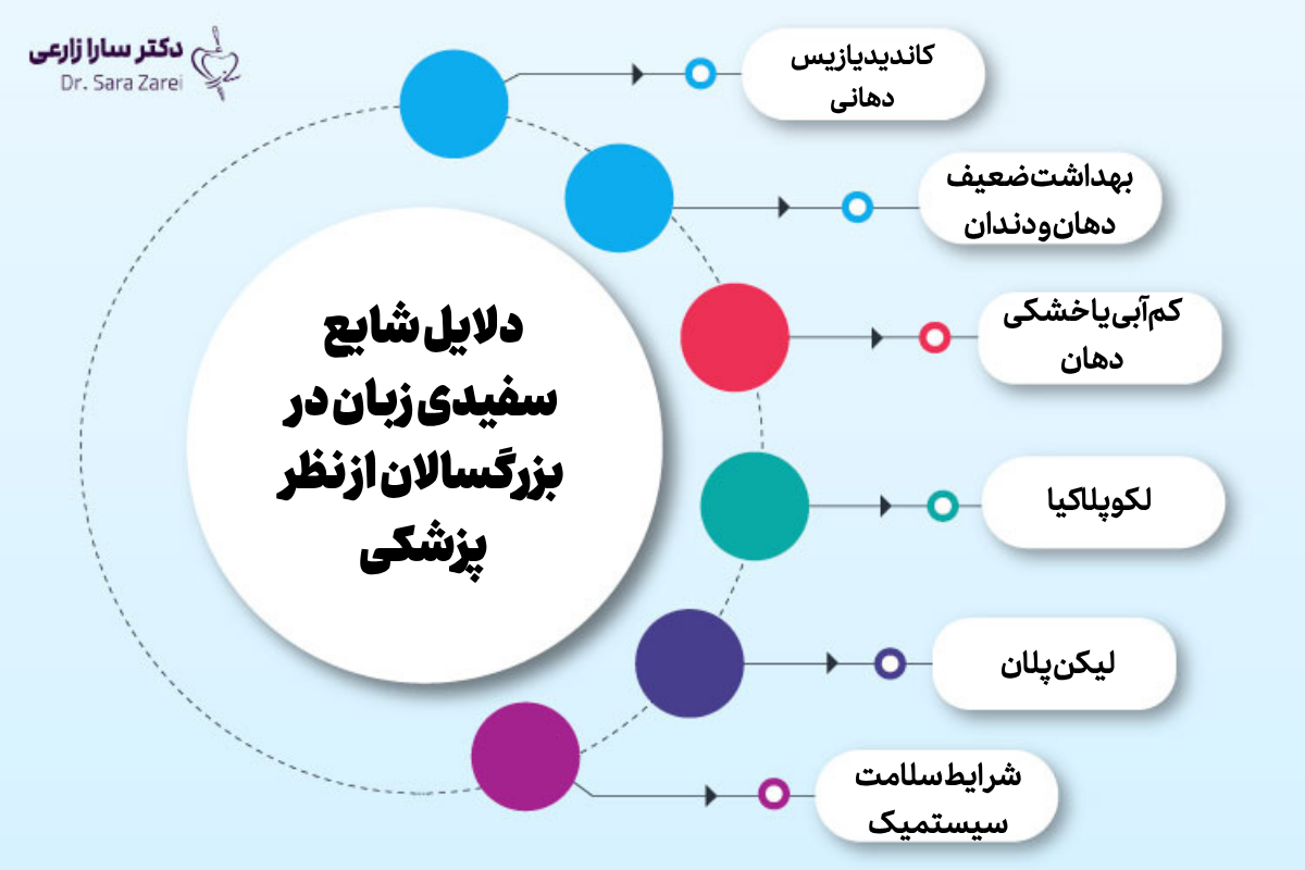 دلایل شایع سفیدی زبان در بزرگسالان از نظر پزشکی