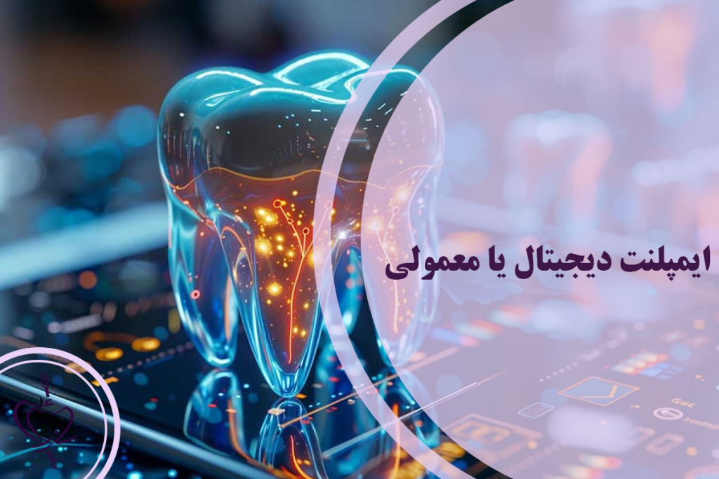 ایمپلنت دیجیتال یا معمولی