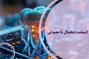 ایمپلنت دیجیتال یا معمولی