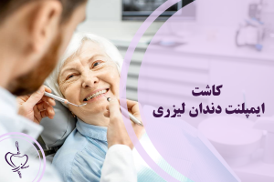 کاشت ایمپلنت دندان لیزری