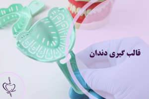 قالب گیری دندان