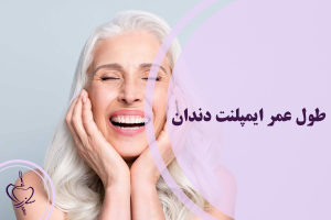 طول عمر ایمپلنت دندان