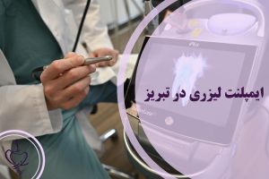 ایمپلنت لیزری در تبریز