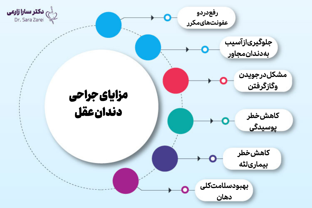 مزایای جراحی دندان عقل