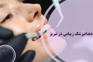 دندانپزشک زیبایی در تبریز