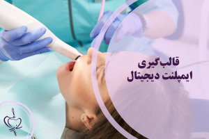قالب‌گیری ایمپلنت دیجیتال