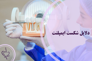 دلایل شکست ایمپلنت