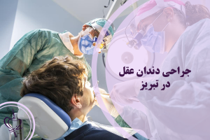 جراحی دندان عقل در تبریز