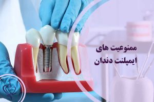 ممنوعیت های ایمپلنت دندان