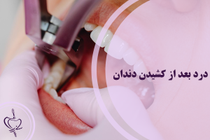 درد بعد از کشیدن دندان
