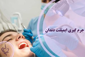 جرم گیری ایمپلنت دندان