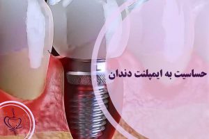 حساسیت به ایمپلنت دندان