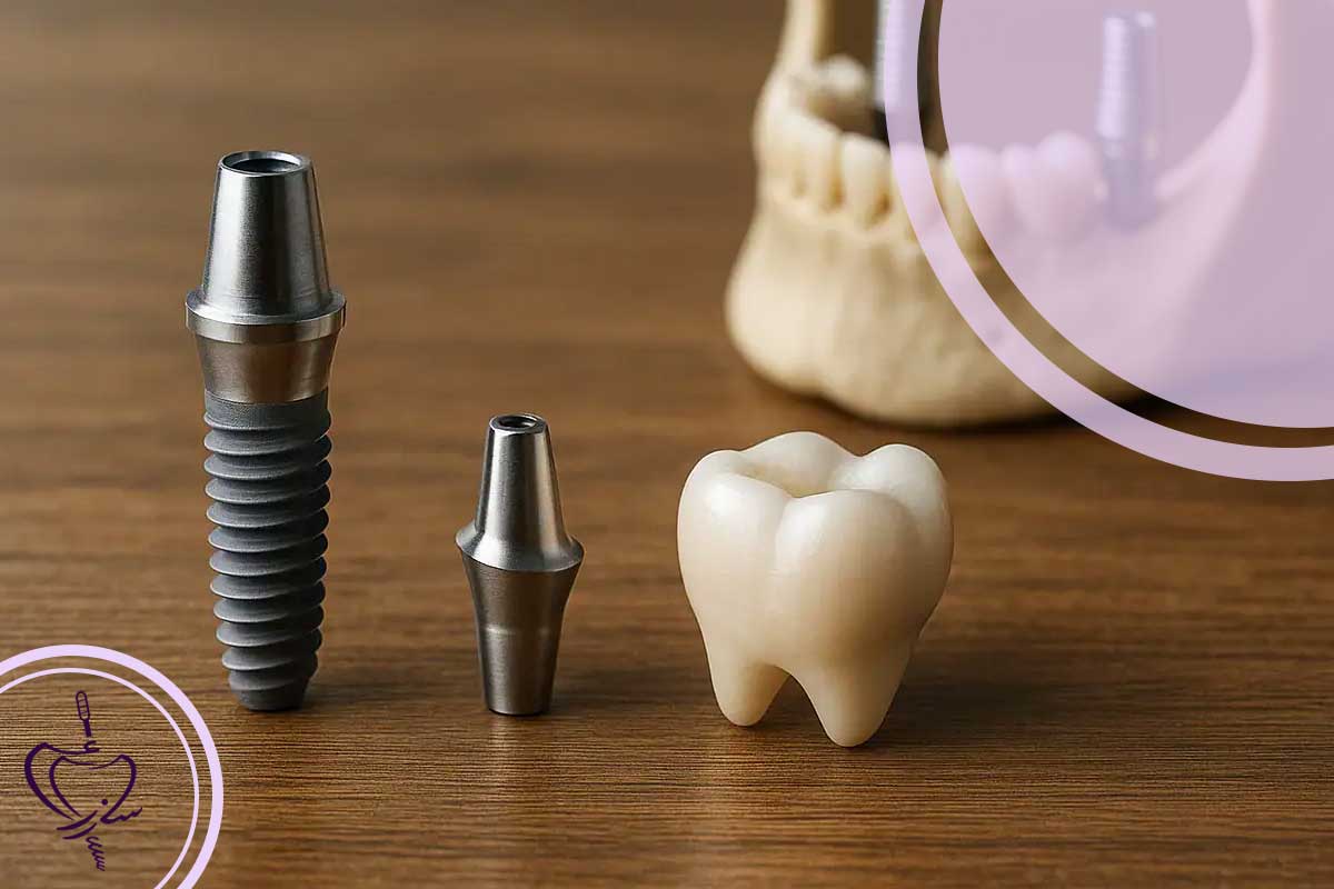 ایمپلنت معمولی