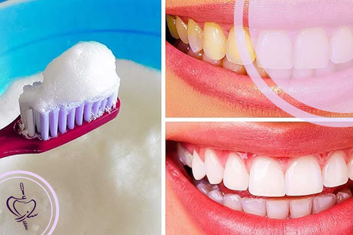 آناتومی لکهها: چرا دندانهای ما زرد و کدر میشوند؟