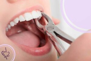 بهترین دکتر برای کشیدن دندان در تبریز
