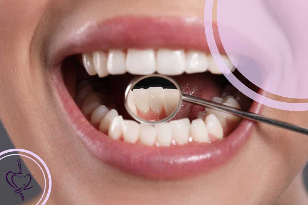 آیا عفونت لثه واگیردار است؟