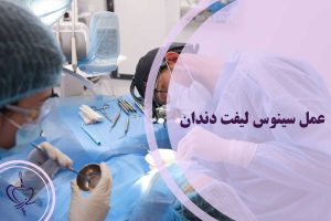عمل سینوس لیفت دندان