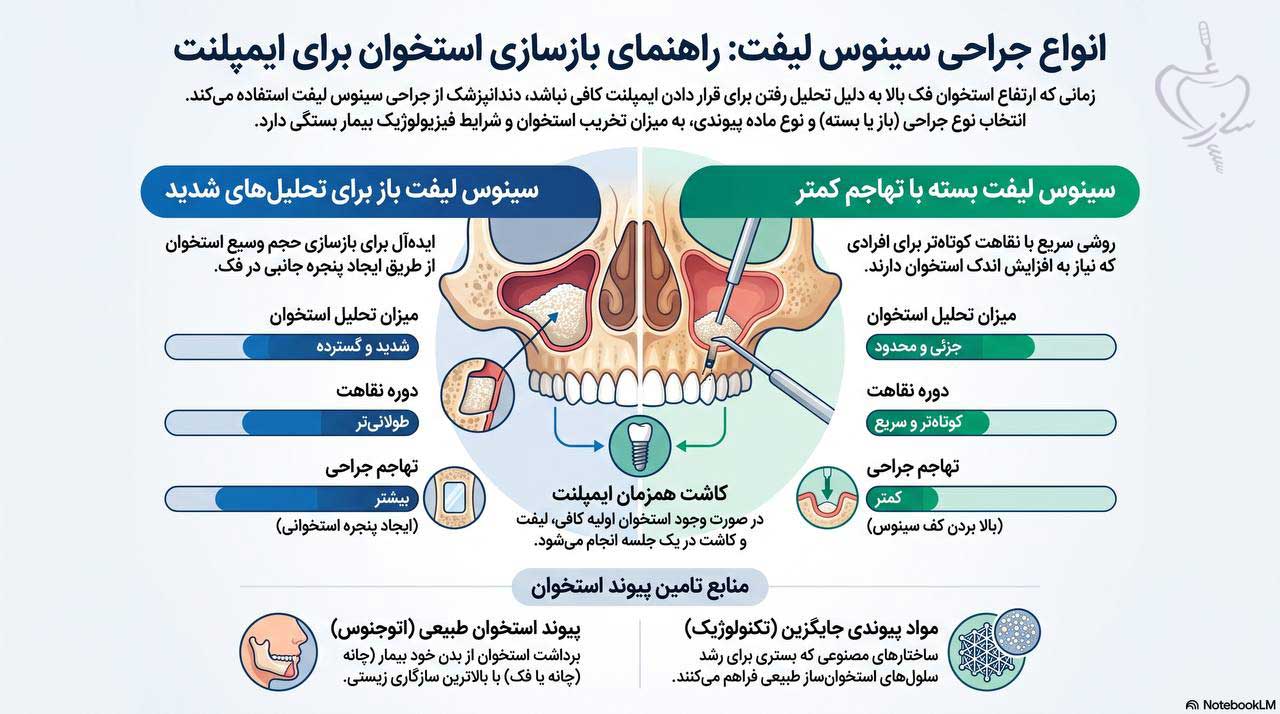 انواع عمل سینوس لیفت دندان