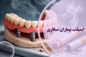 ایمپلنت بیماران سیگاری