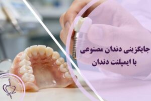 جایگزینی دندان مصنوعی با ایمپلنت دندان