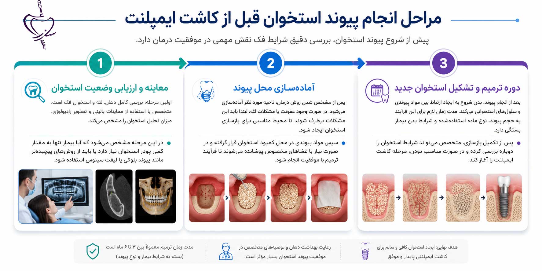 مراحل انجام پیوند استخوان قبل از کاشت ایمپلنت
