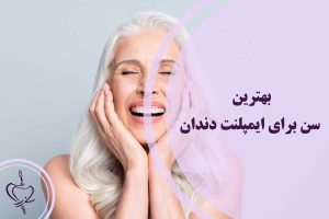 بهترین سن برای ایمپلنت دندان