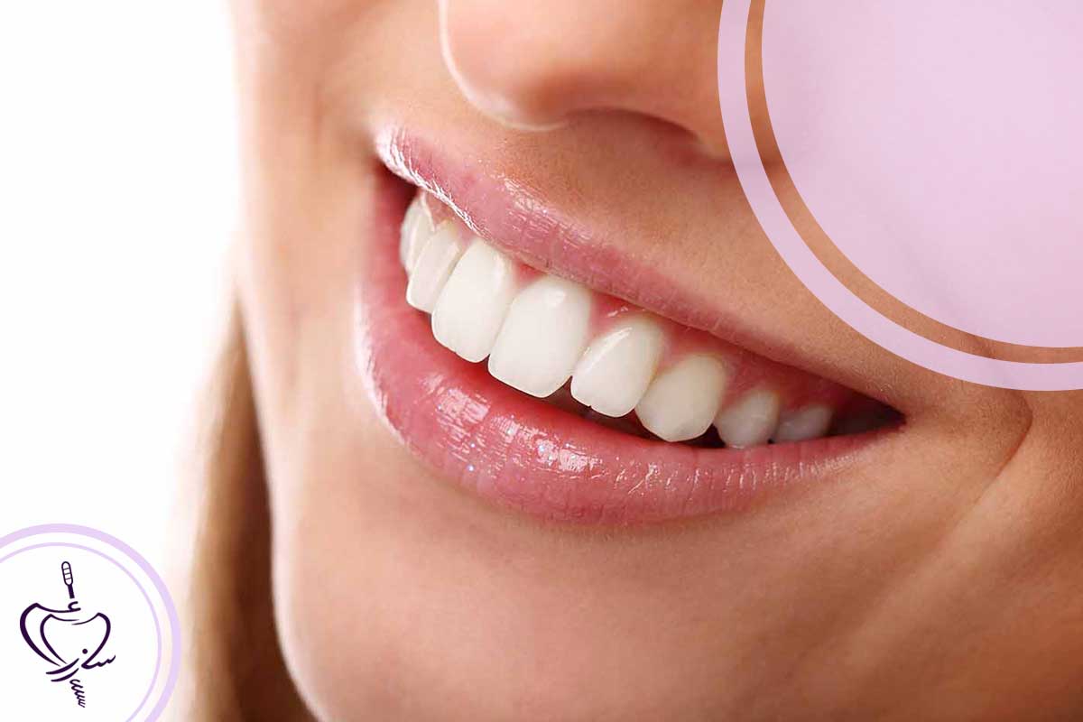 افراد مناسب برای استفاده از خدمات دندانپزشکی زیبایی