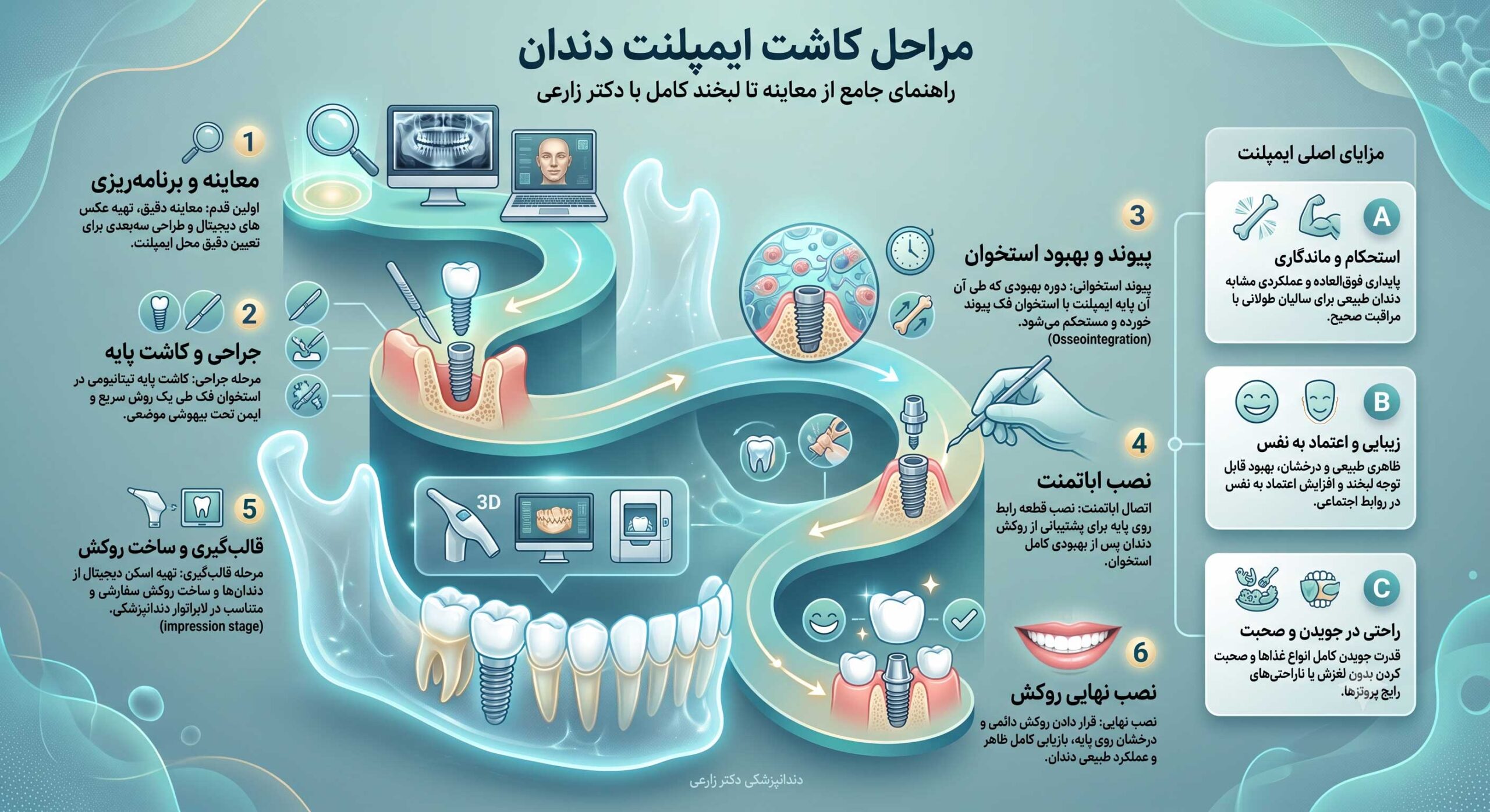 مراحل و روش های کاشت ایمپلنت دندان