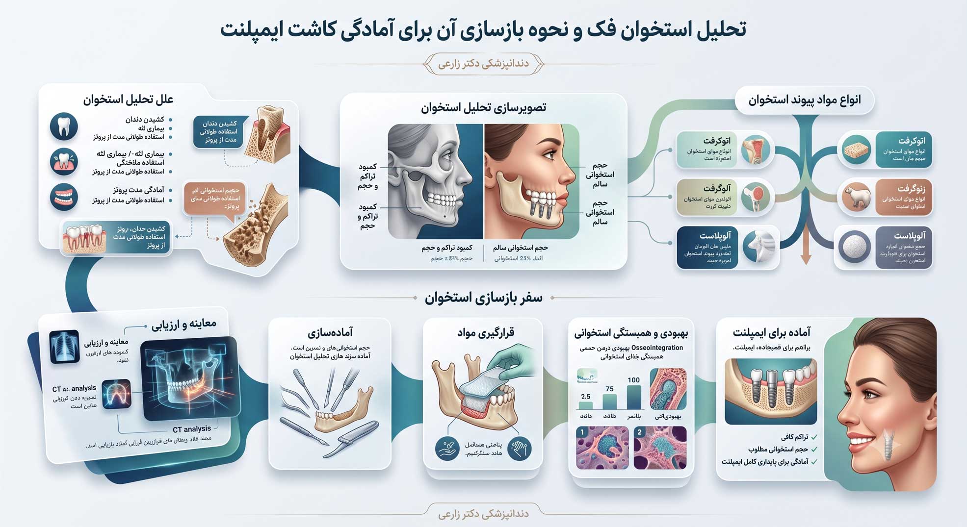 پیوند لثه و استخوان