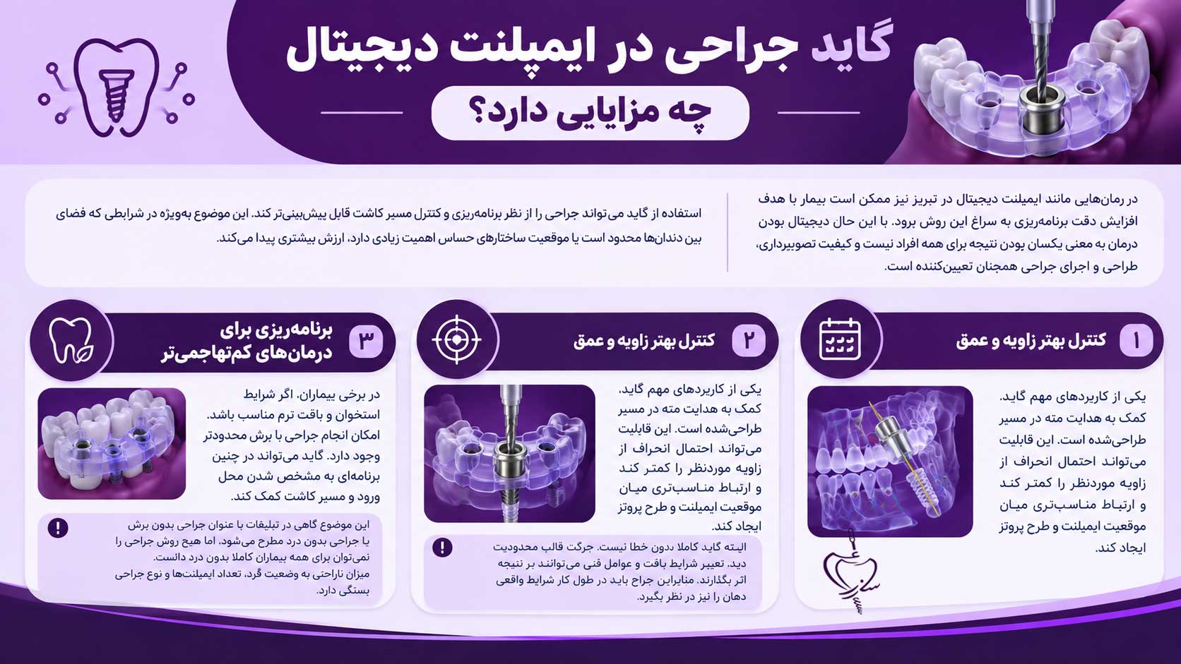مزایای گاید درجراحی ایمپلنت دیجیتال