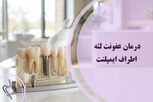 درمان عفونت لثه اطراف ایمپلنت