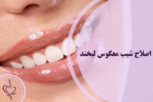 اصلاح شیب معکوس لبخند