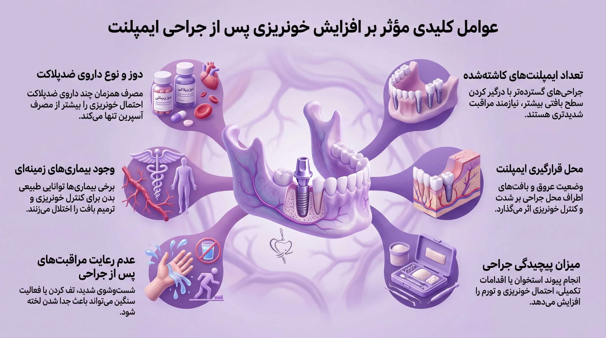 عوامل مؤثر بر افزایش خونریزی بعد از جراحی ایمپلنت