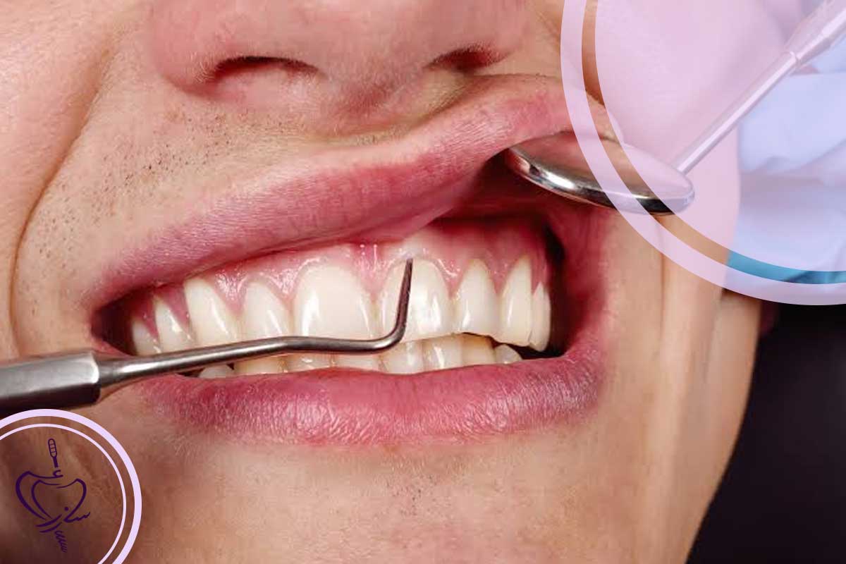 اصلاح فرم لثه و زیبایی لبخند